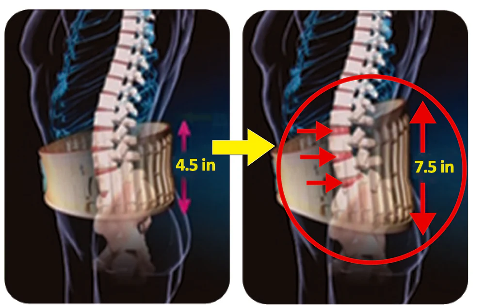 2-in-1 Decompression Back Belt - Image 2