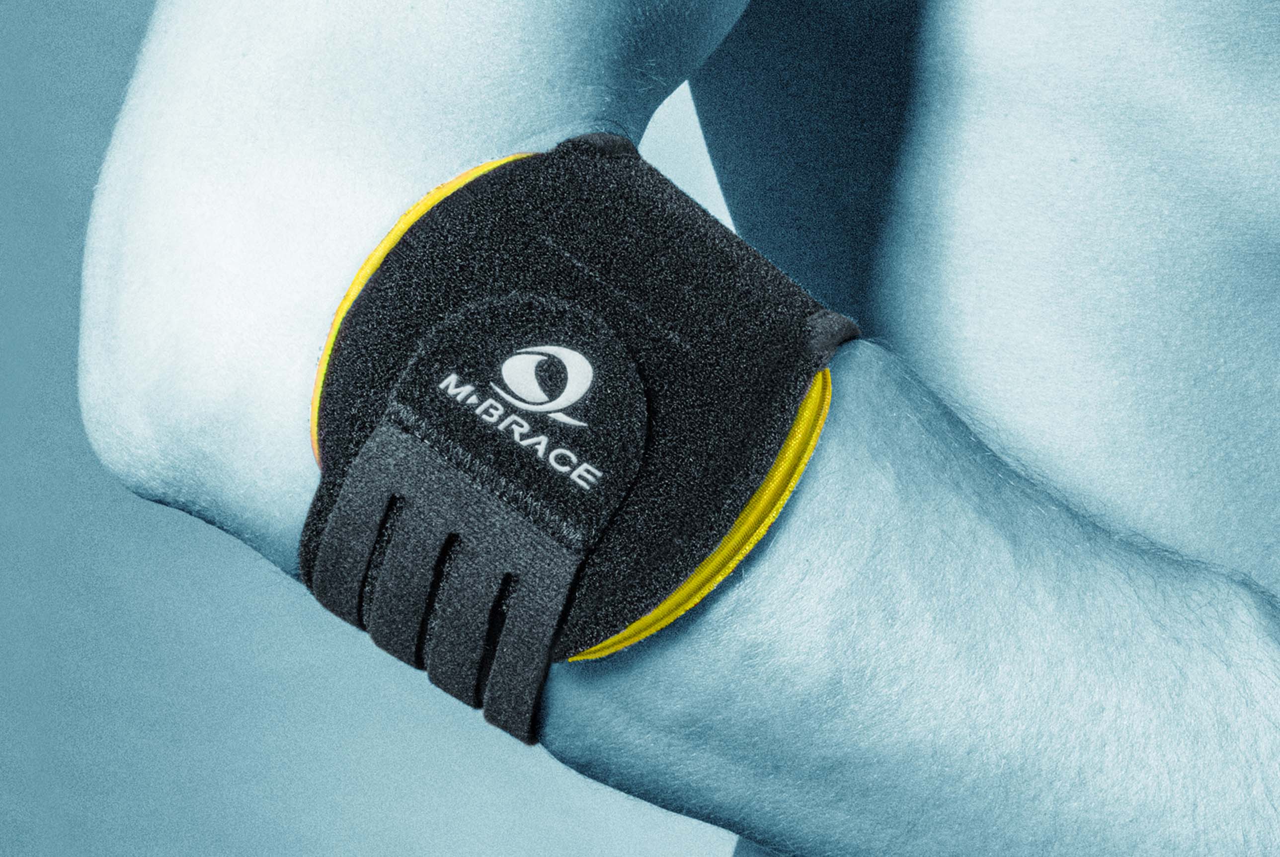 Tennis Elbow