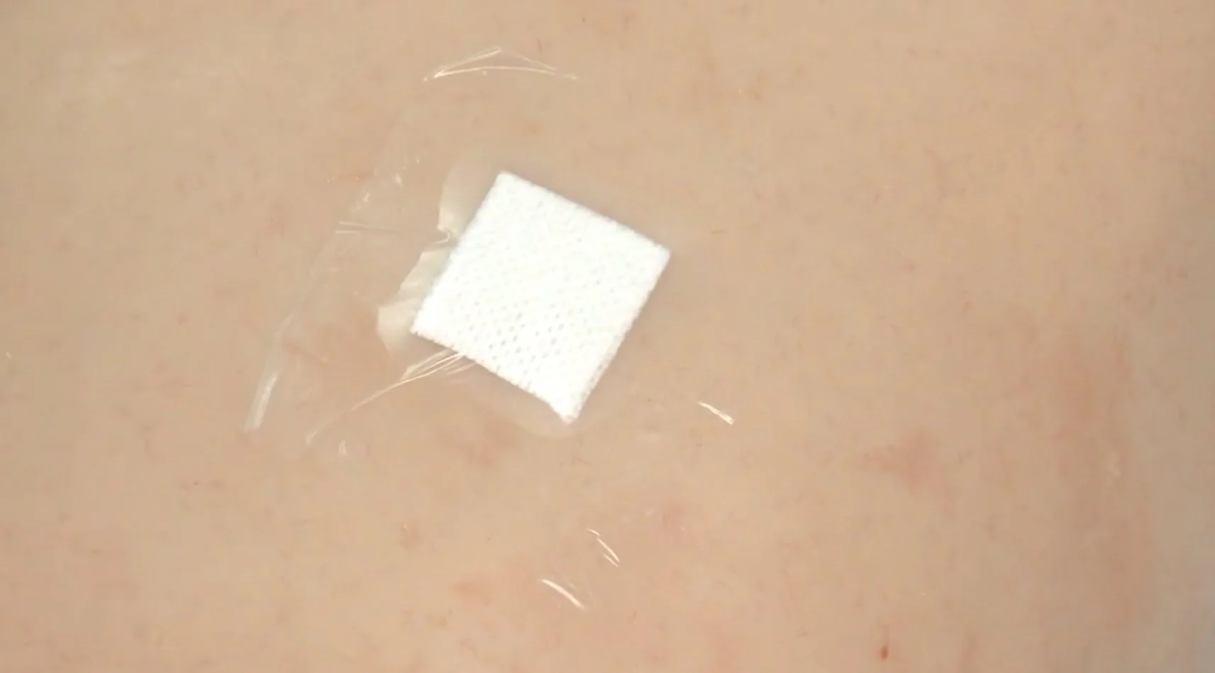 Mepore Film Dressing